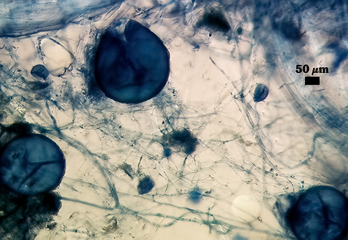 Blue stained spores amongst hyphal material