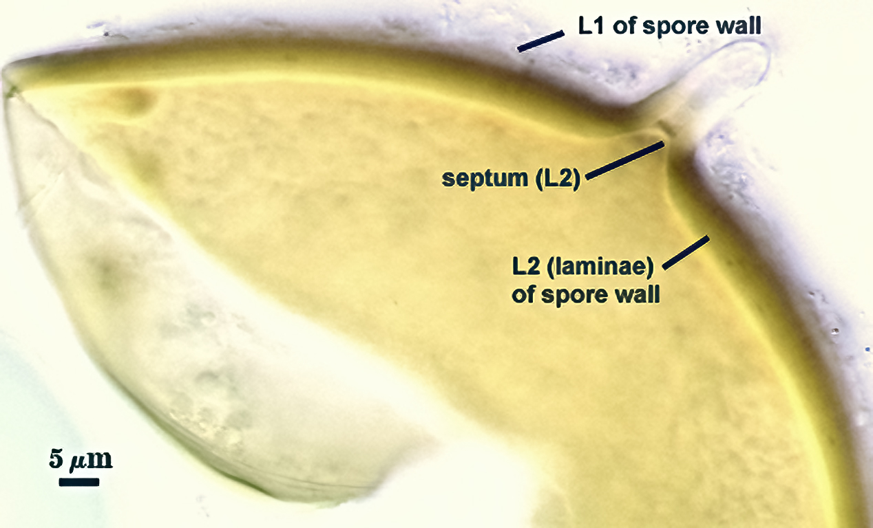 Smashed sphere L2 forms septum between spore and hyphae