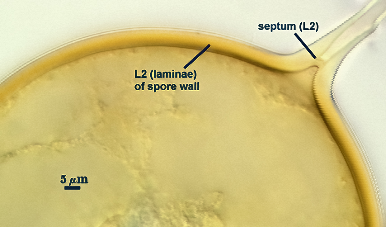 Smashed sphere L2 thick curved line forms septum and contiguous hyphal attachment