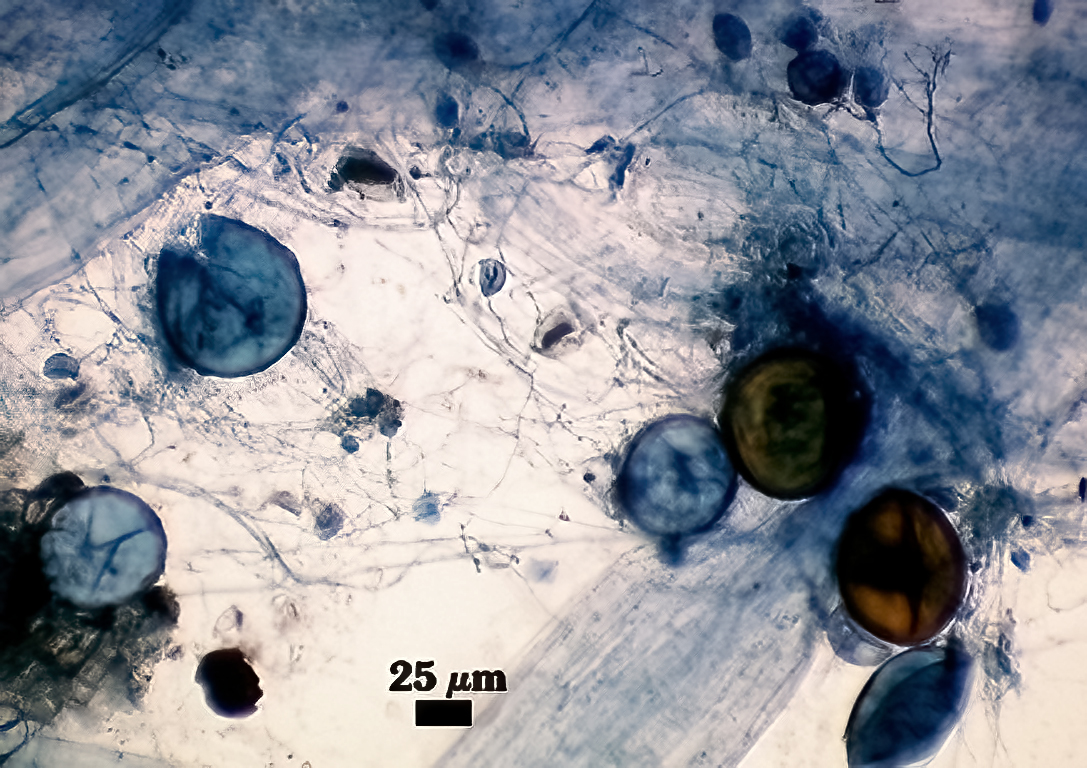 Stained spores walled spheres