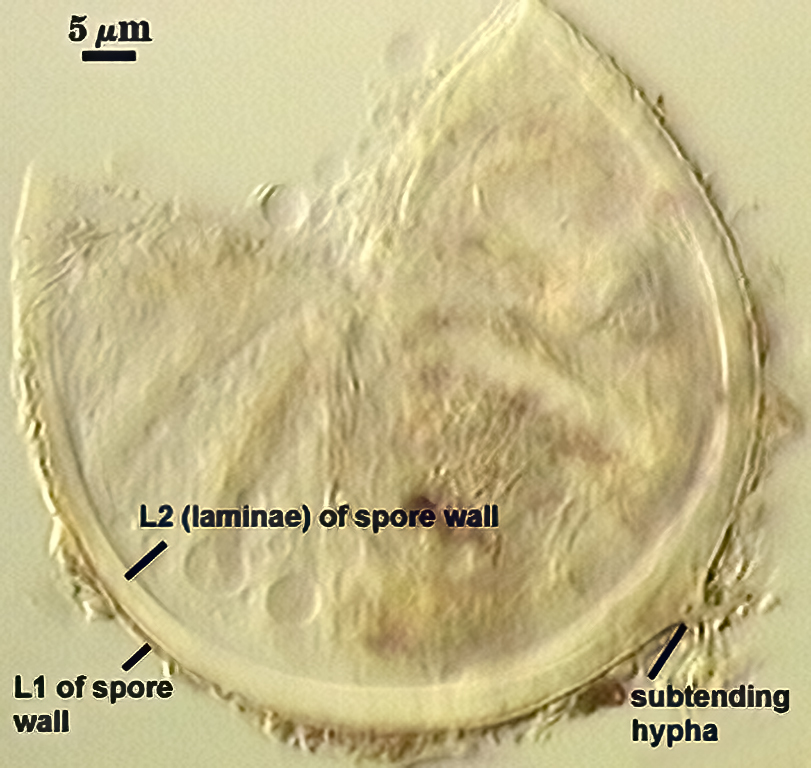 Smashed spore subtending hyphae stem like