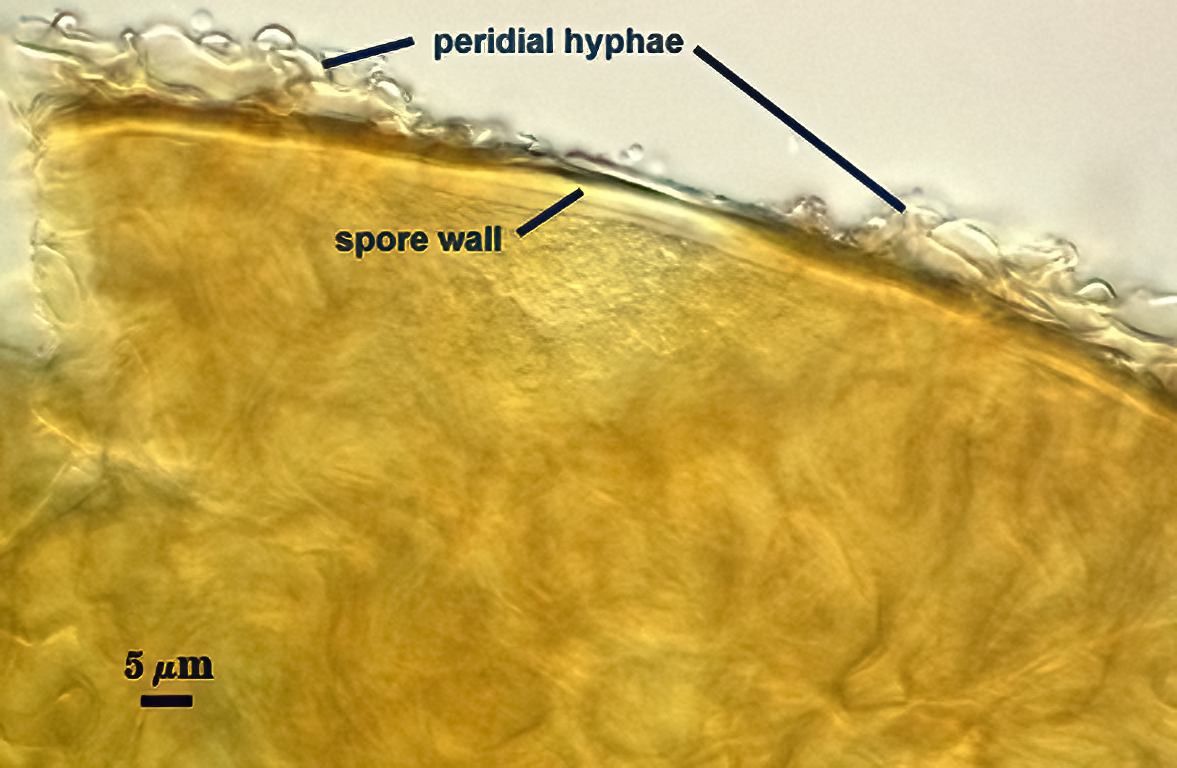 perideal hyphae clear spore yellow in melzers