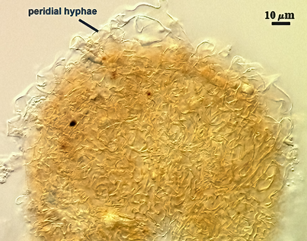 Perideal hyphae thick swirling layer on smashed spore