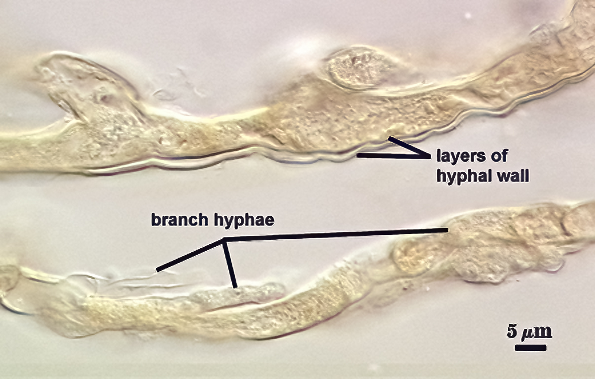 subtending hypal wall layers branching curvilinear clear thick hyphal wall