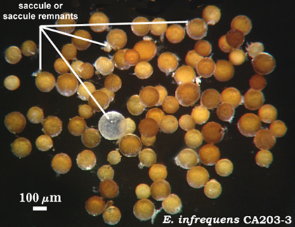 Brown orange spheres and transparent spheres saccules