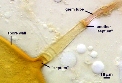 Germ tube L1 L4 septum 2