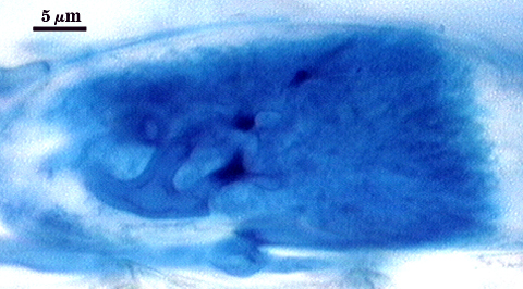 Arbuscule in root soft cloud of darker blue filling root cell 3