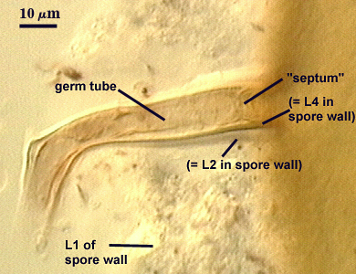 Germ tube L1 L4 septum