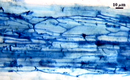 Hyphae dark blue organic linear between lighter blue root cells 2
