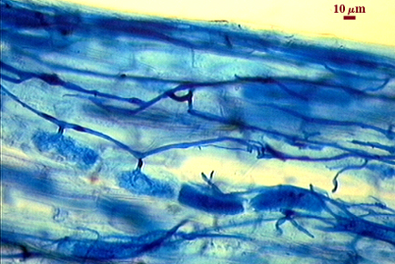 Hyphae dark blue organic linear between lighter blue root cells