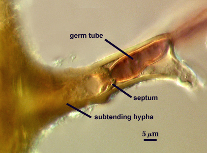 Germ tube pocket over septum in subtending hypha