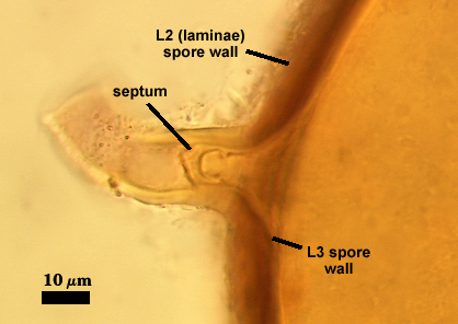 Smashed spore septum arches into hypha