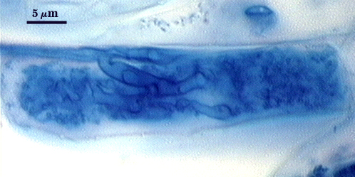 Arbuscule in root soft cloud of darker blue filling root cell