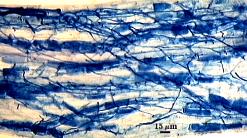 Arbuscules many dark spots in lighter root fragment Hypha dark blue organic lines