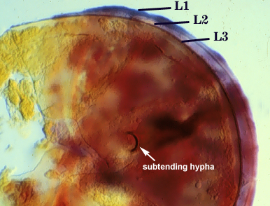 Smashed spore L1 L2 L3 distinct curved lines subtending hypha bump