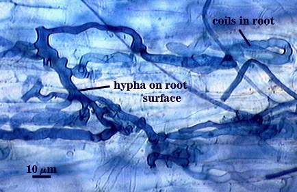 Coiled hyphae curving thick wormlike branched hyphae on root surface