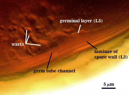 L1 L2 germ tube channel L3 germinal layer warts