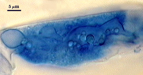 Arbuscule in root soft cloud of darker blue filling root cell