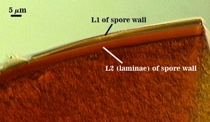 L1 thinner outer curved line L2 thicker inner curved line with laminae
