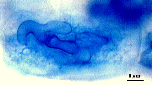 Arbuscule in root soft cloud of darker blue filling root cell with hypha