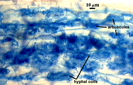 Arbuscules many dark spots in lighter root fragment and hyphal coils