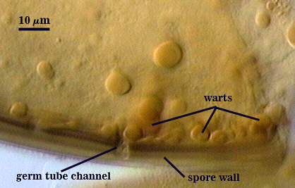 Warts cirlces germ tube channel through spore wall