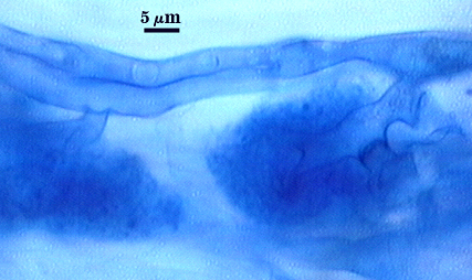 Arbuscule in root soft bush shape with stem which is hypha of darker blue filling root cell