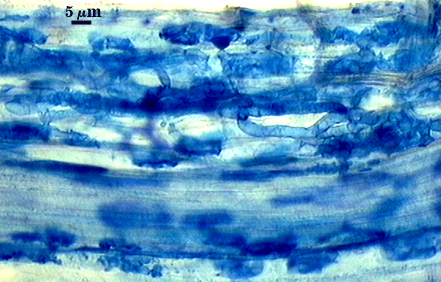 Hyphae darker blues organic linear in root tissue