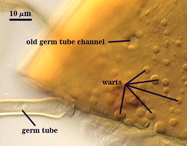 Warts surface circles germ tube