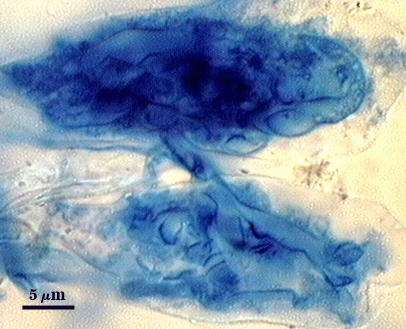 Arbuscule in root  soft cloud of darker blue filling root cell