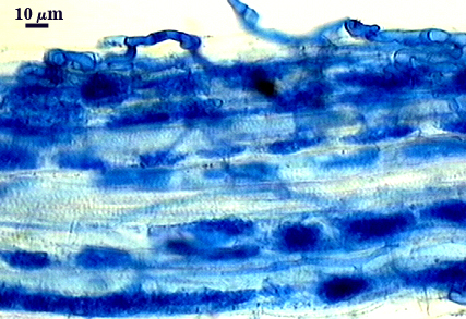 Arbuscules many dark spots in lighter root fragment