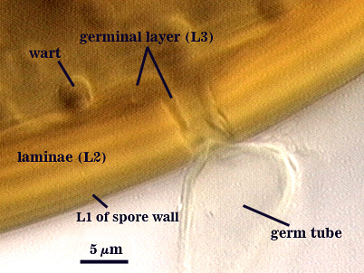 Germ tube through spore wall to germinal layer wart r circular bump