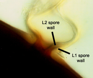Sporogenous cell teardrop with hyphal stem attached to spore wall L1 L2 contiguous
