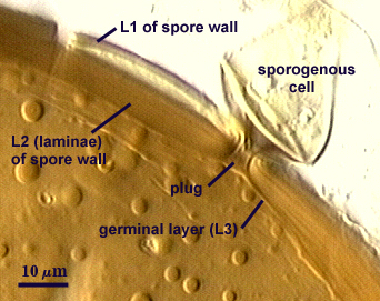 Sporogenous cell teardrop with hyphal stem attached to spore wall plug L2 laminae