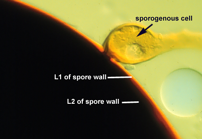 Sporogenous cell teardrop with hyphal stem attached to spore wall