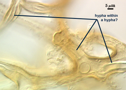 Hyphae in the voucher, possibly associated with the unpigmented spore morphtype