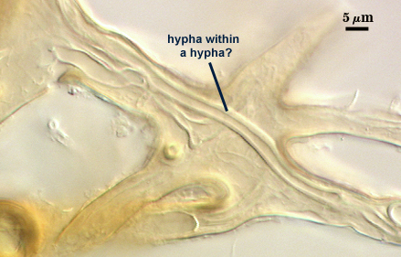 Hyphae in the voucher, possibly associated with the unpigmented spore morphtype