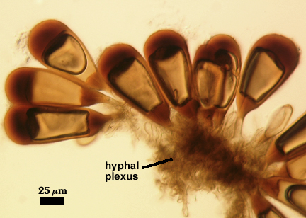 Obovate spores attached to hyphal plexus