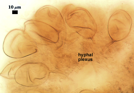 Spores oval attached to hyphal plexus fuzzy matrix