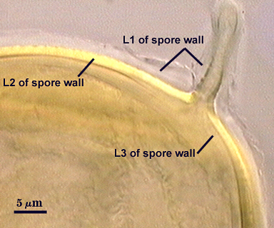 Smashed spore L1 L2 L3 distinct curved lines L1 continues on hyphal attachment stem like