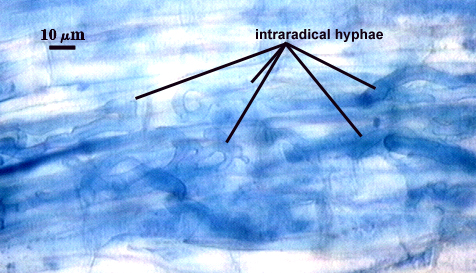 Hyphae organic lines in root tissue
