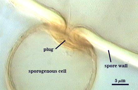 Spore wall thick line opening with seed shaped material which is plug covering opening plug inside spherical pouch sporogenous cell