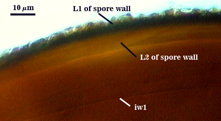 L1 spore wall bumby ornamentation