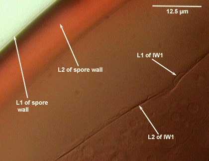 L1 thin outer L2 thick inner spore wall