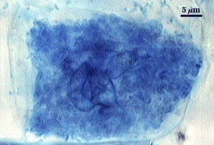 arbuscule dark blue dense cloud fills cell
