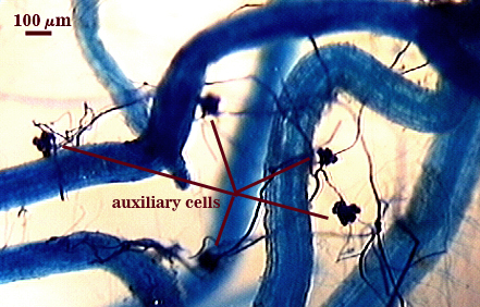 auxilary cell dark irregular small on stringy hyphae outside of root