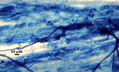 Dark blue organic lines hyphay in root