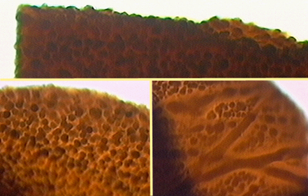 surface spore ornamentation dense warty bumps