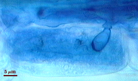 Arbuscule in root soft could of darker blue filling root cell