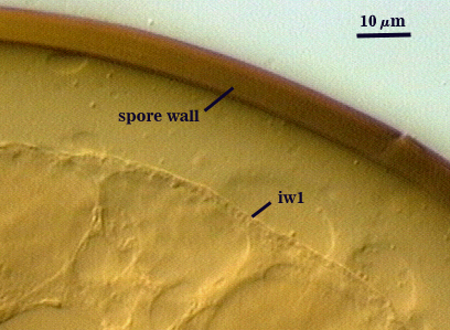 Spore wall iw1 within irregular edge